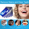 iZhuoKe 28 Pieces Teeth Whitening Strips,Teeth Whitening,Professional Teeth Stain Removal,Whiten