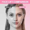 Xanthelle Face Lifting Tape, Transparentes Tape für Gesicht mit V