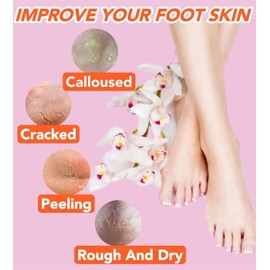 2 Pairs Silicone Socks for Dry Cracked Feet Women,Silicones Moisturizing Socks,Foot Spa Pedicure Silicone Socks for Repairing Dry Feet,Cracked Heels and Softening Rough Skin(Fits Size 8 to 11)