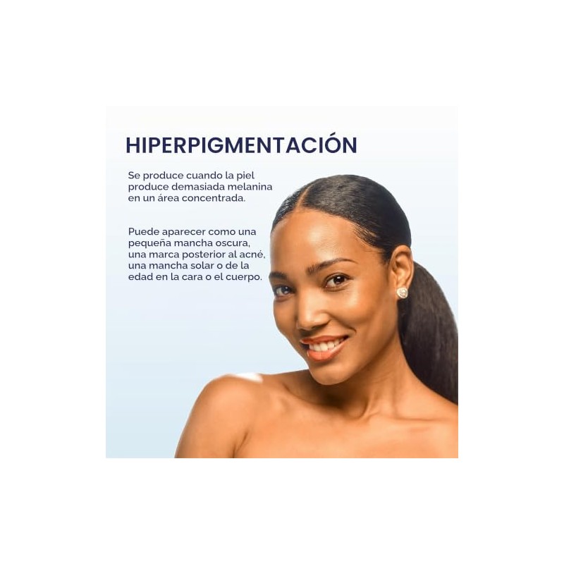 Palmer's Skin Success Fade Milk - Loción Corporal Aclarante, Dermatológicamente