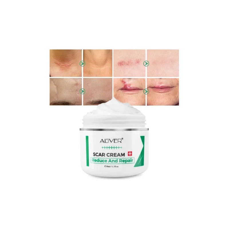Crema Repara Cicatrices Antiedad Quemaduras Estrías