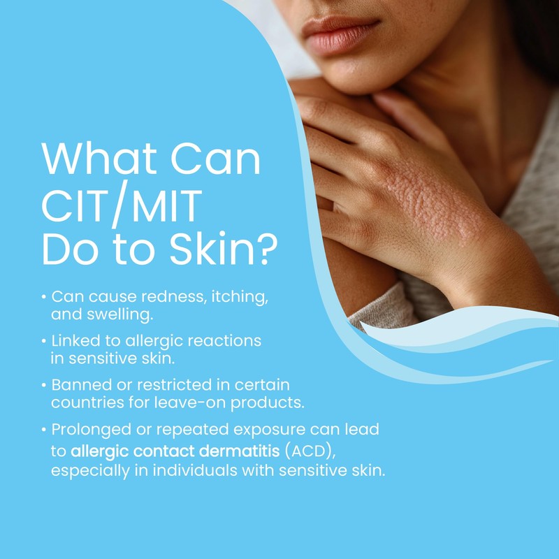 SONOSKIN Ultrasound Conductive Gel CIT, MIT and Paraben Free -