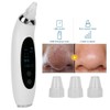 Electric Facial Pore Cleansing Remove Blackhead Acne Vacuum Suction Instrument