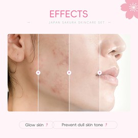 Set De 8 Piezas Sakuraskincare Para El Cuidado Facial Completo Con Vitamina C. Incluye Limpiador, Srum Tnico, Contorno De Ojos, Crema De Esencia, Horquilla Sakura, Cuerda Para El Pelo