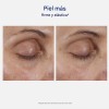 Crema Antienvejecimiento Neostrata Para Ojos 14g