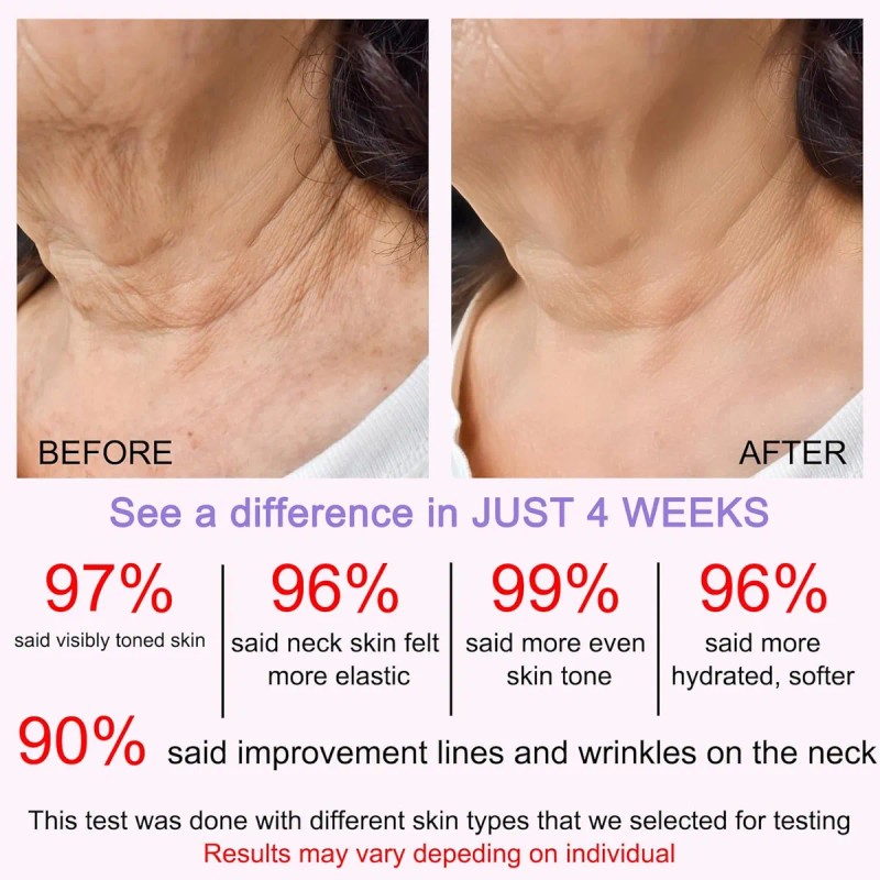 Crema De Cuello Para Crepey Skin Body Care Comfort