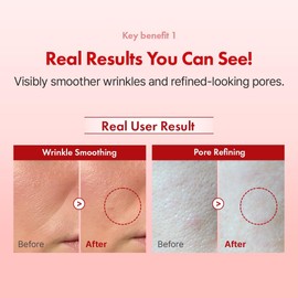 Hanskin- Crema facial con retinol, repara líneas finas y arrugas, crema hidratante antienvejecimiento, para suavizar y reafirmar la piel.