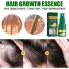 30ml 4PCS Ginger Hair Growth Spray Nutritious Moisturizing Hair Root