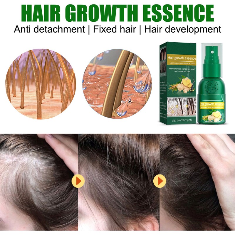 30ml 4PCS Ginger Hair Growth Spray Nutritious Moisturizing Hair Root
