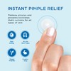 KEYCONCEPTS Pimple Patches for Face (240 Patches), Hydrocolloid Acne Patches