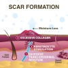 Scar Aid (pro-sil) Gel Silicón En Lápiz Para Cicatrices