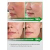 BEAUDIANI Cica Ampolla Mascarilla 100Ea, Almohadilla Para El Cuidado De