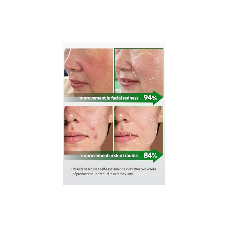 BEAUDIANI Cica Ampolla Mascarilla 100Ea, Almohadilla Para El Cuidado De