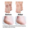 Replacement Roller Compatible with Dr. Scholl's Callus Remover Electronic Foot