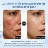 Ácido Azelaico Crema Con 20% Vitamina C Y Niacinamida Todo