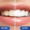 Lápiz Blanqueador Dental Venus Visage, Galardonado, Con Más