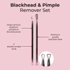 MCoBeauty Blackhead and Pimple Remover Set
