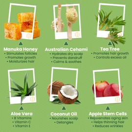 Tea Tree & Honey Shampoo & Conditioner Set - Dandruff Treatment With Organic Tea Tree Oil - Itchy Scalp Treatment for Women & Men - Sulfate and Paraben Free With Manuka Honey Aloe Vera & Coconut (8oz)