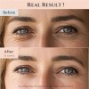 Srum Para Ojos Joseon Revive Beauty 2 -