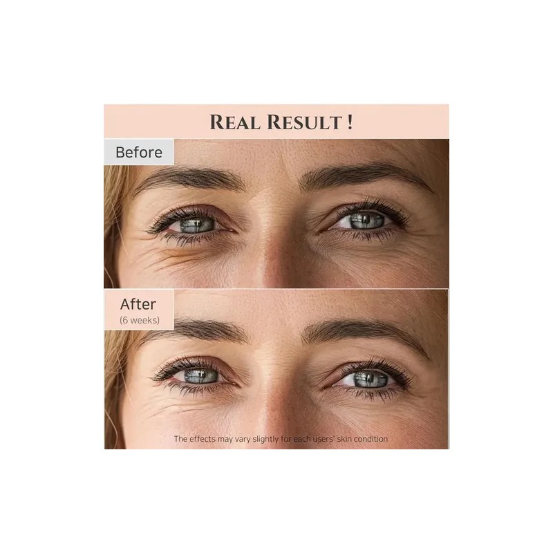Srum Para Ojos Joseon Revive Beauty 2 -