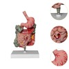 F Fityle Human Digestive System Model,Stomach Section PVC Sturdy Scientific