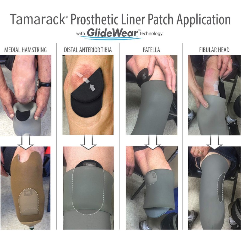 Tamarack Prosthetic Liner Patch with GlideWear Technology (Large, 2 Pack)