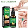 JAYSUING 【Buy 1 Get 1 Free】JAYSUING Ginger Nail CareSerum, Moisturizes,