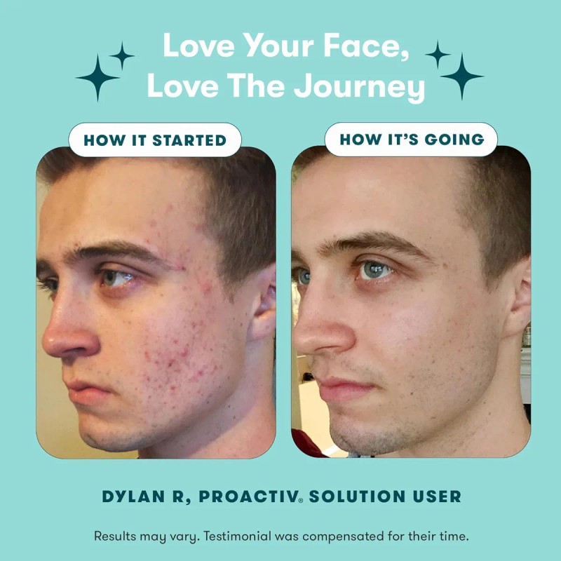 Kit Tratamiento Facial Anti Acne Proactiv 3 Pasos Reparador