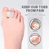 MHSY Gel Toe Separators for Overlapping Toes, 4PCS Bunion Correctors