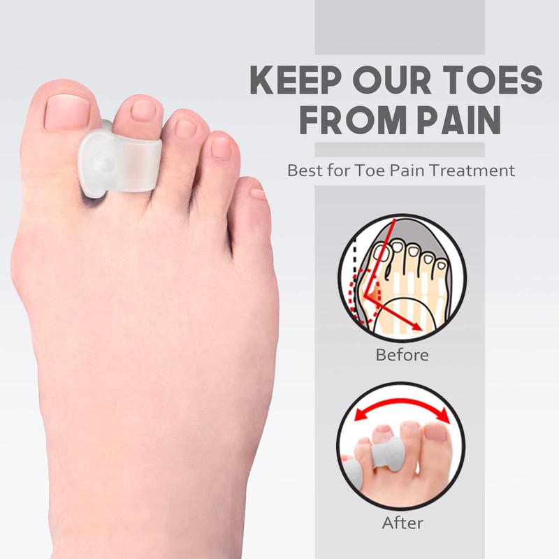 MHSY Gel Toe Separators for Overlapping Toes, 4PCS Bunion Correctors