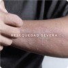 Derman DB Calm Crema Corporal │ Urea-D 10% + Ácido