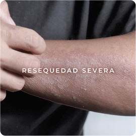 Derman DB Calm Crema Corporal │ Urea-D 10% + Ácido Hialurónico │ 300 g