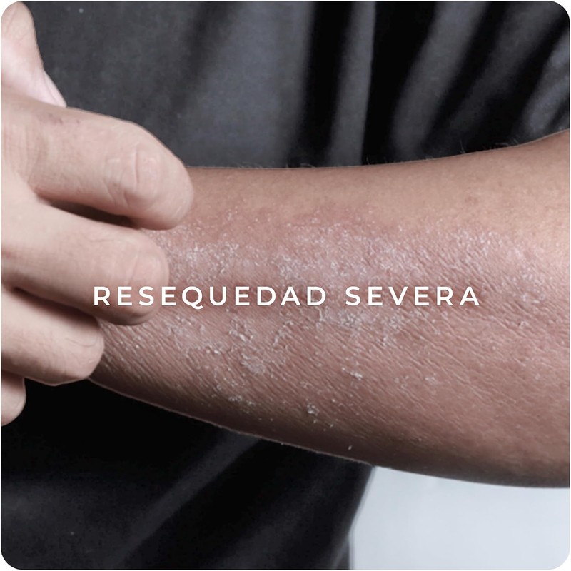 Derman DB Calm Crema Corporal │ Urea-D 10% + Ácido