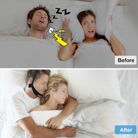 Upgraded Anti Snoring Chin Strap for Men Women Adjustable Stop Snoring Solution Chin Straps Sleep Aids for Snoring Mouth Breather