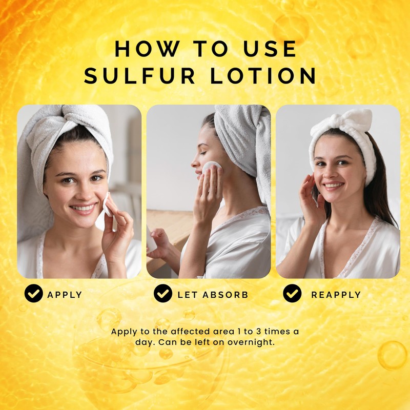 Pili Sulfur Lotion – Helps Control Oily Skin & Reduce
