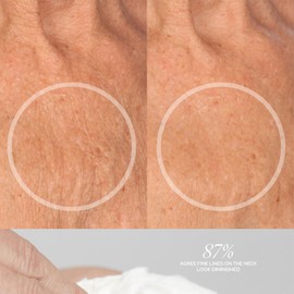 SiO Cryo Neck & Décolleté Cream - Firming & Smoothing Neck & Décolleté Treatment