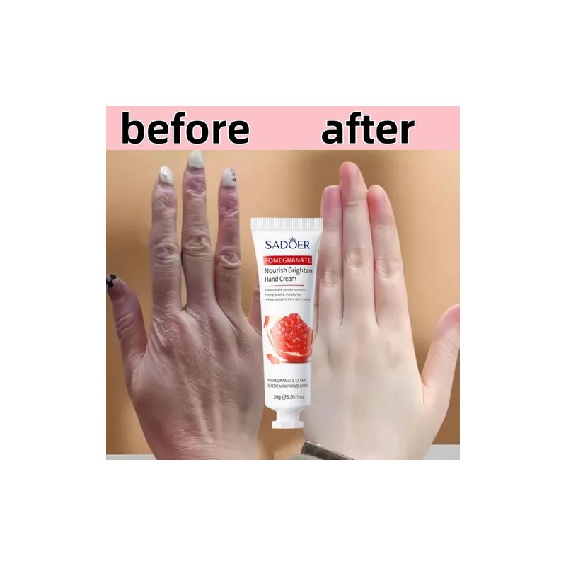 Crema De Manos Reparadora Antiarrugas Para Manos Antiarrugas