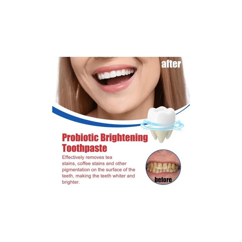 Sp-6 Whitening Probiotics Toothpaste Toothbrushes, 3pcs