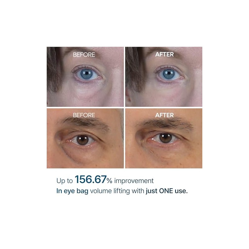 Dr.Melaxin Eyephalt Eyebag Cream 10ml