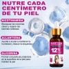 Aceite Acantosis Nigricans, Mejora La Hiperpigmentac Neutra
