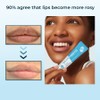 Abera Fordyce Seeds - Lip Acne, Moisturizes, Improves Dry, Chapped