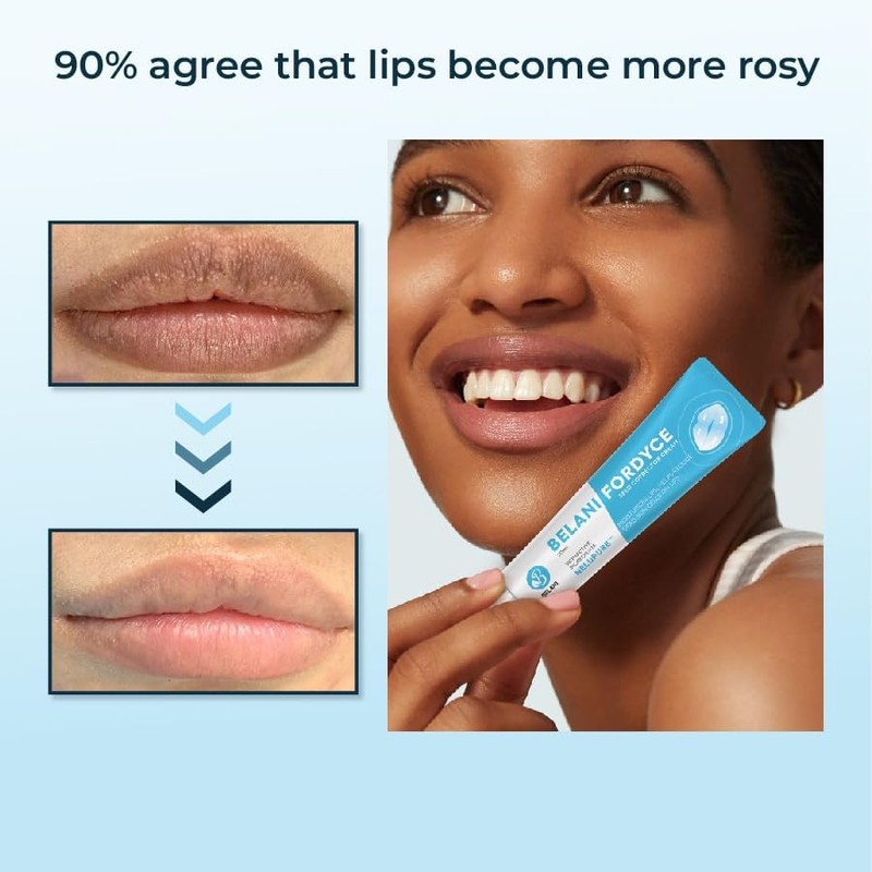 Abera Fordyce Seeds - Lip Acne, Moisturizes, Improves Dry, Chapped