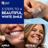 Crest 3D White Whitestrips Supreme Flexfit Teeth Whitening Kit