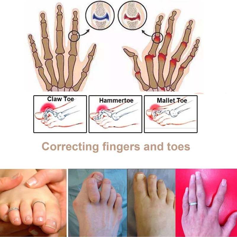 AYNKH 3PCS Finger Buddy Wraps Tapes, Fabric Toe Brace Splint