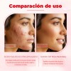 Loción Secante Antiacné Ácido Salicílico 10ml Oukeya