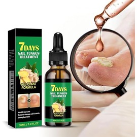 Ginger Nail, Tratamiento de Uñas con Jengibre, Soporte para Uñas, Cuidado de Uñas, Suero para El Crecimiento de Uñas con Jengibre, Aceite Fortalecedor para Uñas