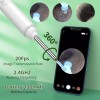 Ear Wax Removal Kit: 1920P HD Camera & 8-Pc Ear