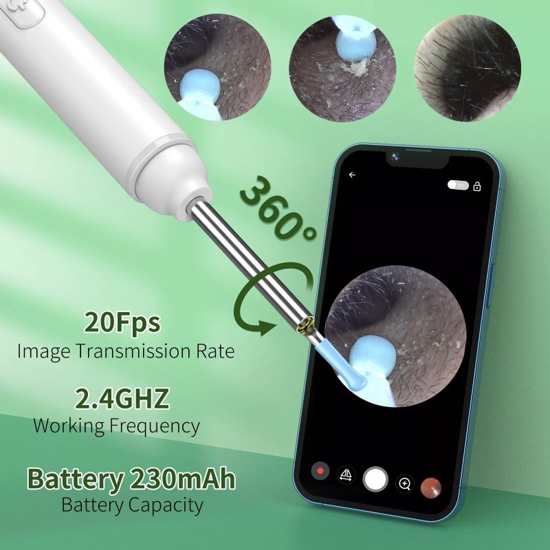 Ear Wax Removal Kit: 1920P HD Camera & 8-Pc Ear