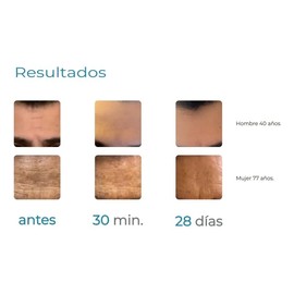 Sérum L Immortalité Hydralift Lineas De Expresión 30 Ml Todo Tipo De Piel Día/noche