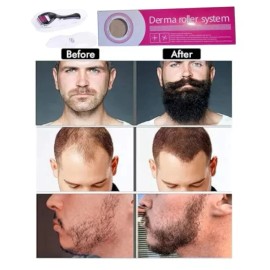 Derma Roller Beard Derma Roller For Hair Loss Beard Growth  Titanium Derma Roller Micro Needl